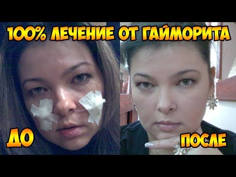 Капли в нос диоксидин