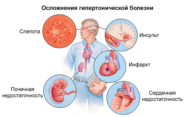 Анаприлин: инструкция по применению и для чего он нужен, цена, отзывы, аналоги