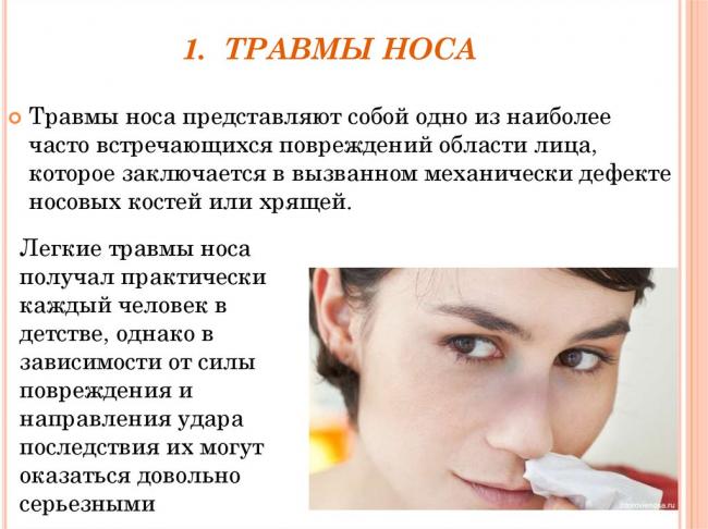 Перелом костей носа: причины, симптомы, лечение