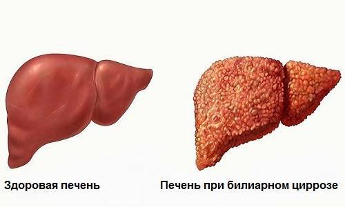 Валсартан: инструкция, аналоги, при каком давлении принимать таблетки?
