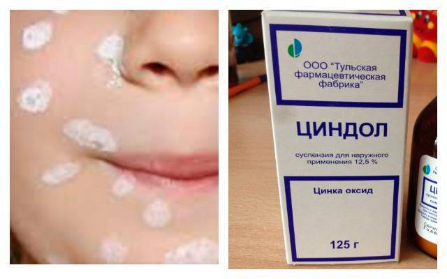 Циндол: инструкция по применению, цена, аналоги и отзывы