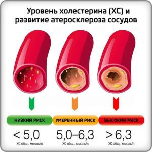 Тромбопол