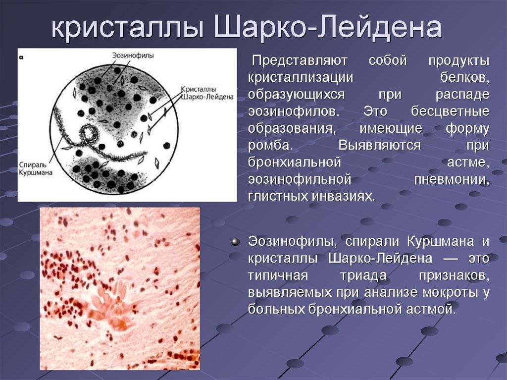 Особенности мокроты при бронхиальной астме, способы выведения экссудата
