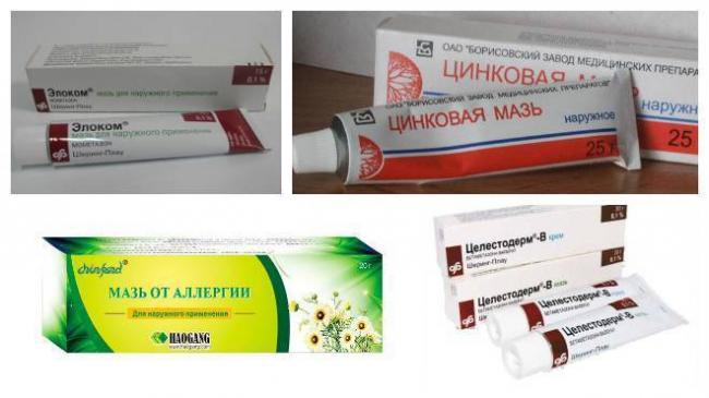 Сыпь на животе у взрослого человека: причины, симптомы, диагностика и лечение
