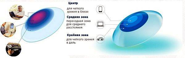 Почему мультифокальная линза подходит не всем?