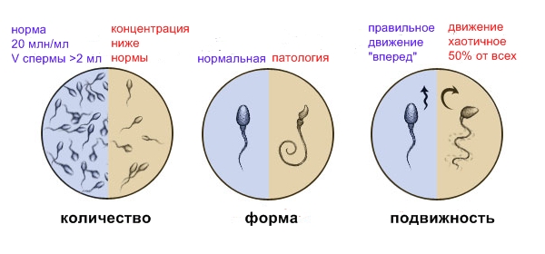 Варикоцеле – причины, симптомы, диагностика. лечение патологии: показания к операции, подготовка, виды операции, после операции. возможные осложнения после операции: боли, отек, швы. прогноз после варикоцеле.