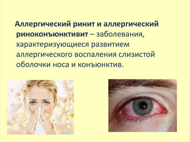 Атрофический ринит: лечение, что это такое, основные симптомы