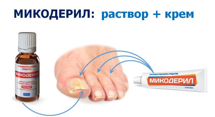 Противогрибковое средство Фармстандарт-Лексредства Микодерил Раствор - отзывы