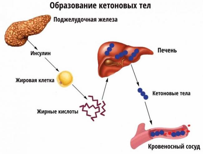 Кетоновые тела в моче у ребенка: повышенные, норма в анализе