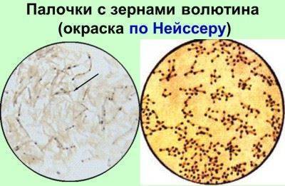 Тинкториальные свойства бактерий. методы окраски