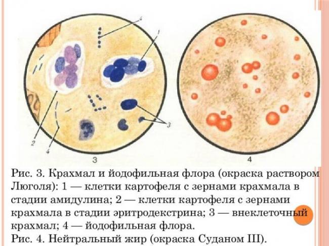 О чем говорит йодофильная флора в кале