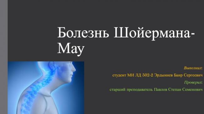 Болезнь шейермана-мау – что это такое? болезнь позвоночника шейермана-мау – лечение