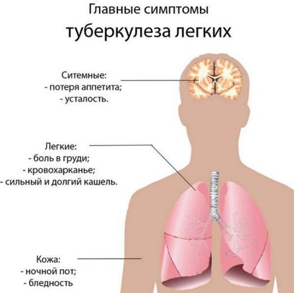 Температура при туберкулезе: фебрильная, субфебрильная, гектическая