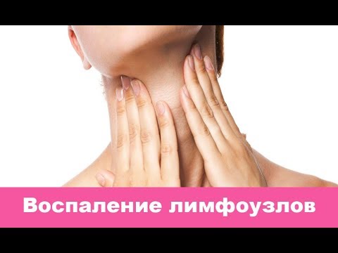 Подчелюстной лимфаденит: причины, симптомы и лечение
