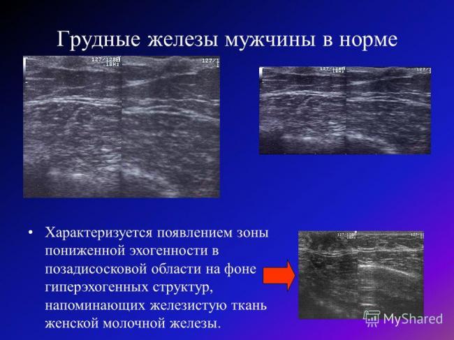 Строение женской молочной железы. анатомия человека