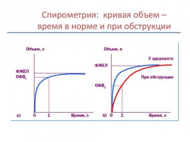 Проведение спирографии при бронхиальной астме