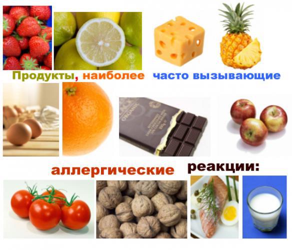 Крапивница у взрослых на теле: причины, симптомы, лечение, фото