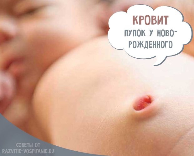 Омфалит