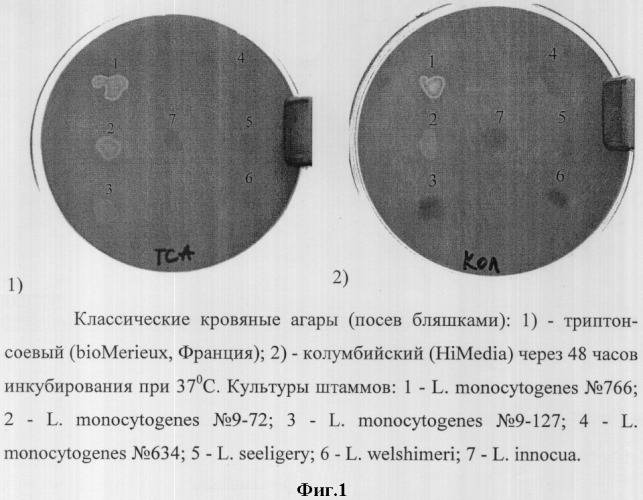 Исследование на бактерии группы кишечных палочек