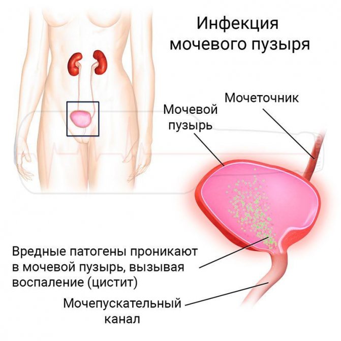 Бруснивер. инструкция по применению сбор, чай, таблетки. цена, аналоги