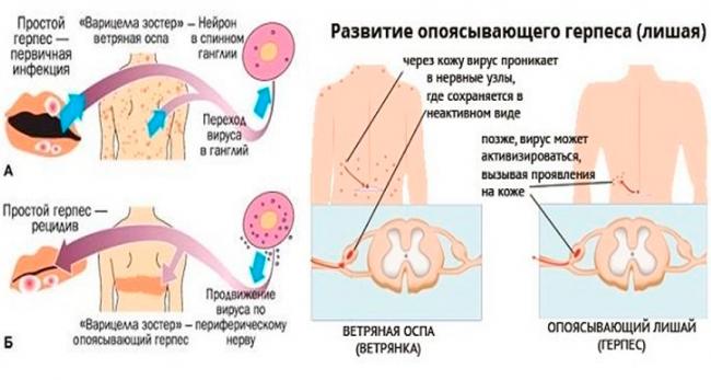 Парвовирусная инфекция: заражение, формы, симптомы, лечение