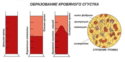 Выход клеток крови из костного мозга. синусоидальное дерево. неэффективность эритропоэза. неэффективный гранулопоэз.