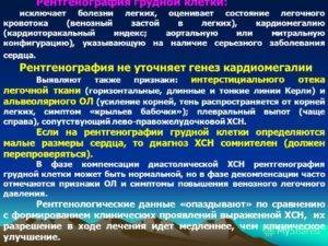 Пневмония на фоне сердечной недостаточности
