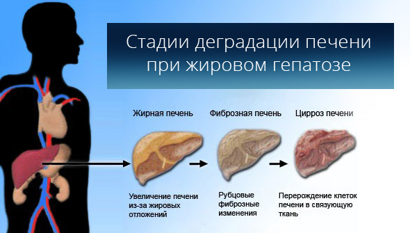 Правильное питание при гепатозе печени с примерным меню на неделю