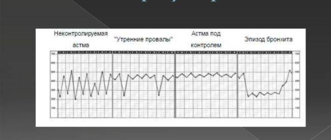 Техника проведения пикфлоуметрии