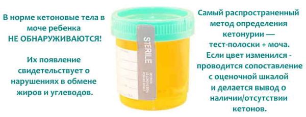 Появление кетоновых тел в моче при беременности