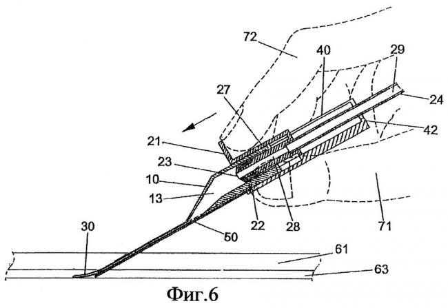 Катетер - catheter - qwe.wiki