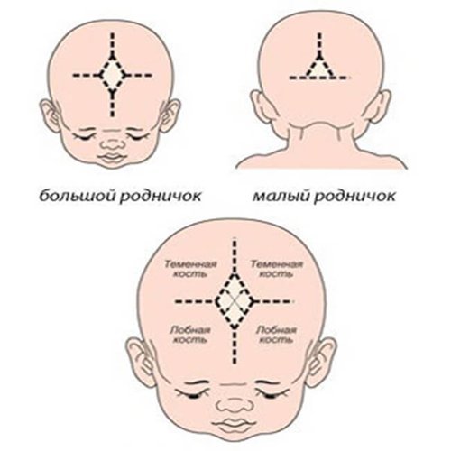 Родничок новорожденных: время закрытия и причины костных аномалий