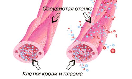Индометацин Софарма