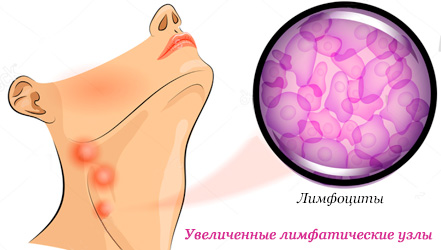 Диета и правильное питание при вирусе герпеса