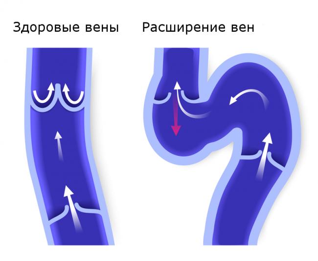 Венодиол инструкция по применению цена отзывы аналоги