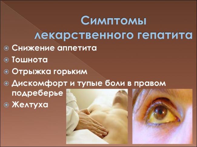 Вирусный гепатит е: причины, симптомы, лечение