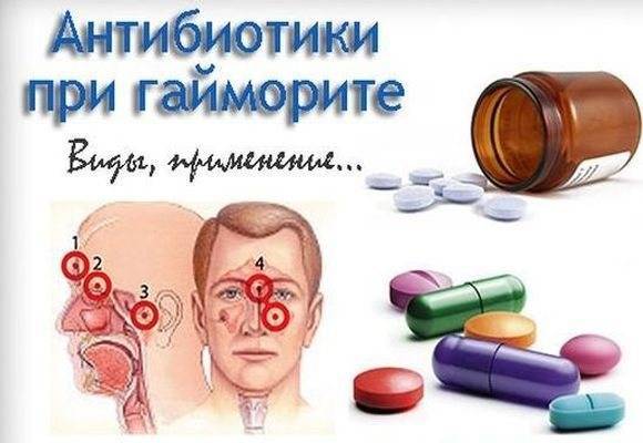 Азитромицин – антибиотик для лечения гайморита