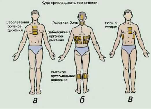 Как ставить горчичники при пневмонии взрослым и детям - onwomen.ru