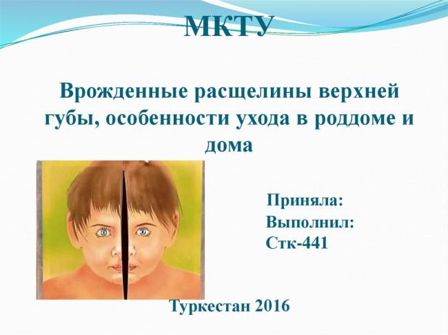 Волчья пасть у детей