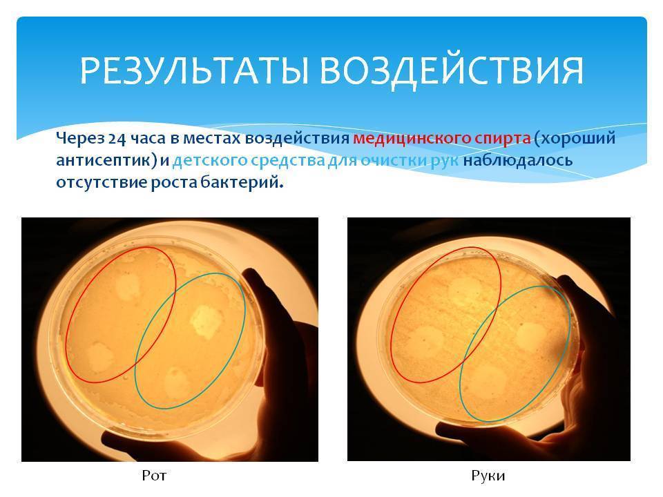 Полезные бактерии. роль и значение бактерий в жизни человека. фото