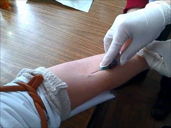 Эссенциале Н , Раствор для внутривенного введения