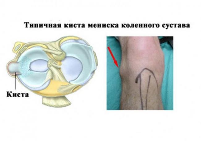 Аллергия в виде шишек на теле