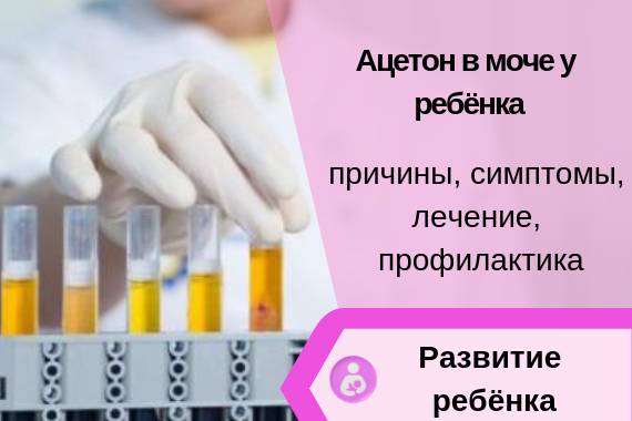 Кетоновые тела (кетоны) в моче при беременности: причины, симптомы, лечение, диета
