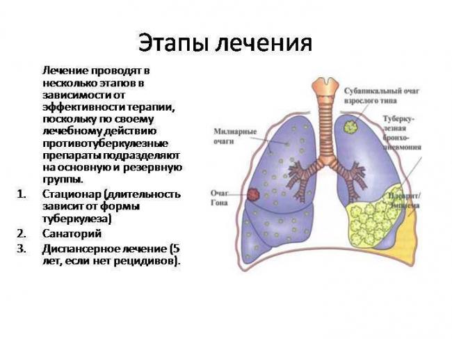 Лечение туберкулеза легких народными методами
