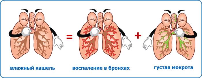 Сильный влажный кашель у ребенка чем лечить