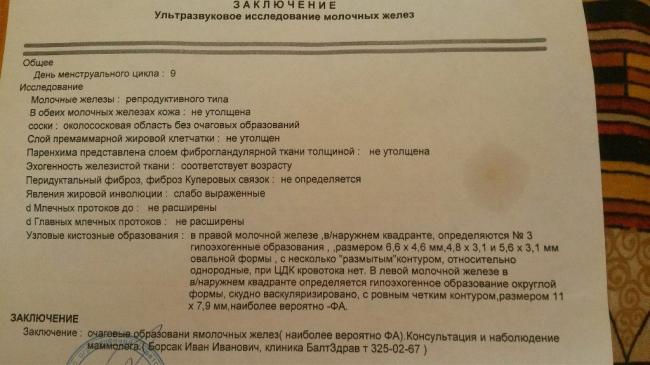 Строение женской молочной железы