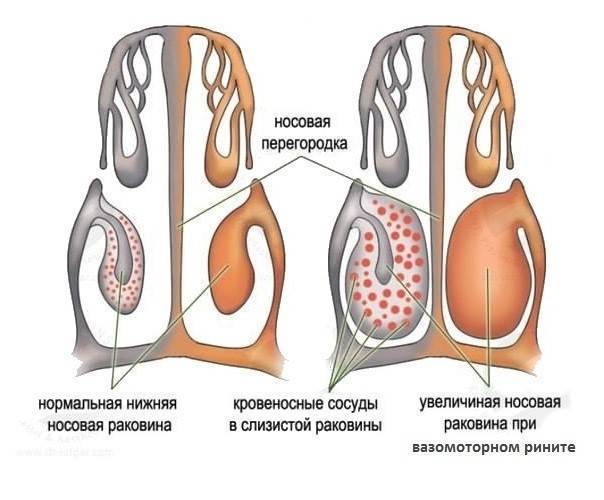 Нос дышит но заложенность есть