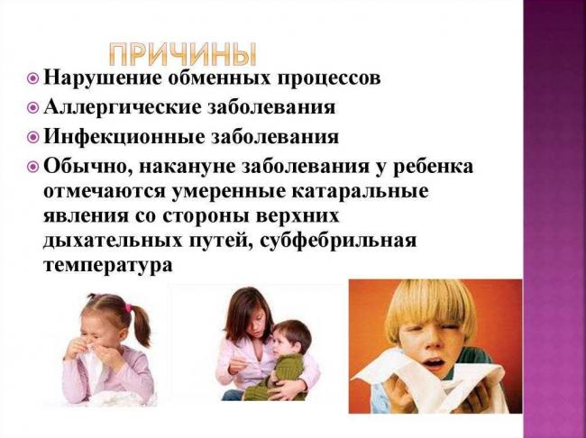 Симптомы и лечение ложного крупа у детей