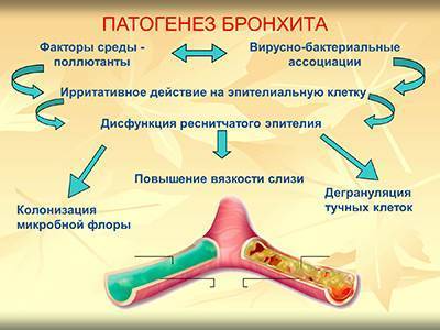 Острый бронхит. симптомы и лечение, антибиотики, народные средства, таблетки