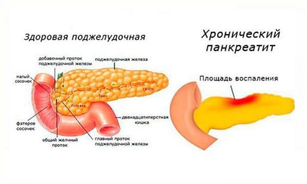 Белки глаз пожелтели